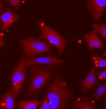 TPP2 Rabbit Polyclonal Antibody