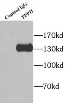 TPP2 Rabbit Polyclonal Antibody