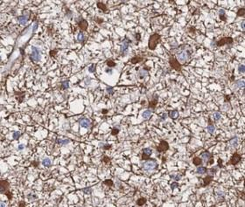 TPP2 Rabbit Polyclonal Antibody