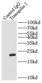 TAGLN2 Antibody