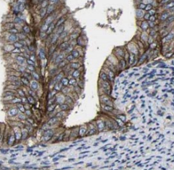 SSR1 Rabbit Polyclonal Antibody