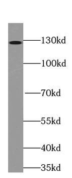 TRAPPC9 Mouse Monoclonal Antibody