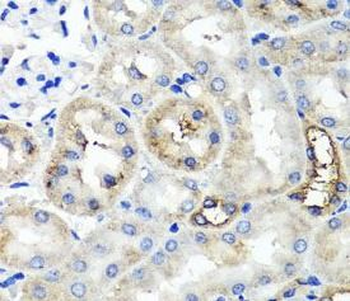 TNFAIP6 Antibody