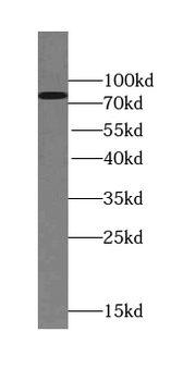 TSNAXIP1 Rabbit Polyclonal Antibody