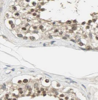 TSNAXIP1 Rabbit Polyclonal Antibody