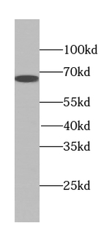 TTC39A Rabbit Polyclonal Antibody
