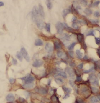 TTC39A Rabbit Polyclonal Antibody