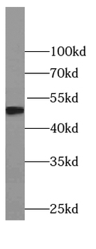 TDP2 Rabbit Polyclonal Antibody