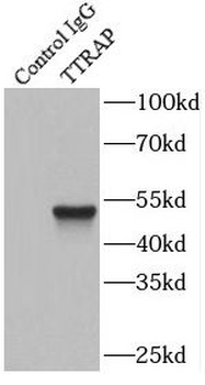 TDP2 Rabbit Polyclonal Antibody