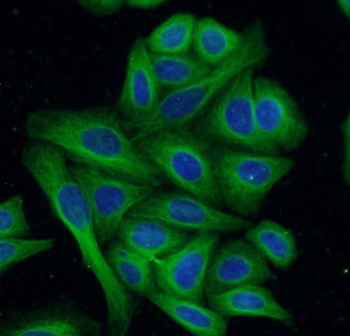 Beta Tubulin Antibody