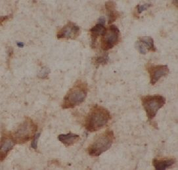 Beta Tubulin Antibody