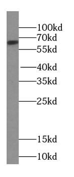U2AF2 Rabbit Polyclonal Antibody