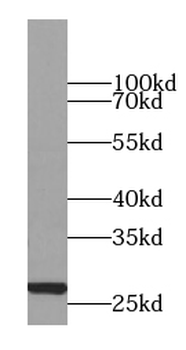CMPK1 Rabbit Polyclonal Antibody