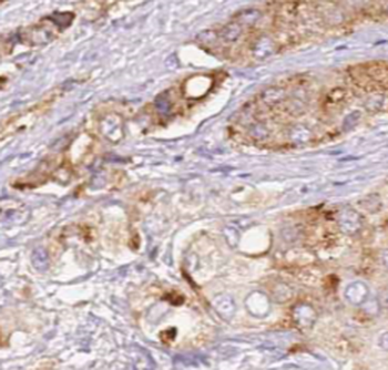 CMPK1 Rabbit Polyclonal Antibody