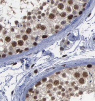USP13 Mouse Monoclonal Antibody
