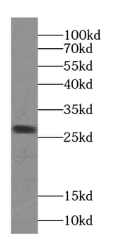 VAPB Antibody