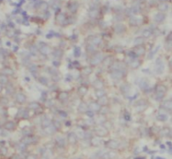 VAPB Antibody