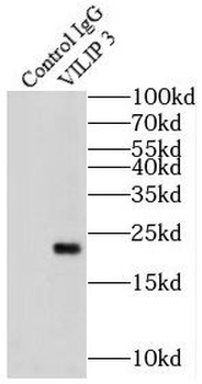 HPCAL1 Antibody