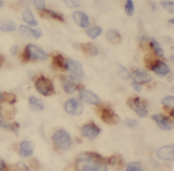 HPCAL1 Antibody