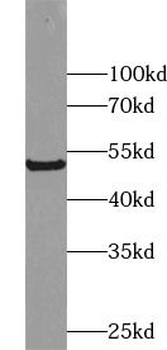 Vitamin D binding protein Antibody