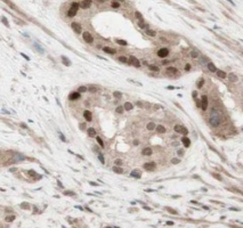 LAT2 Rabbit Polyclonal Antibody