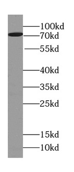 FRMD6 Rabbit Polyclonal Antibody