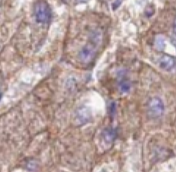 FRMD6 Rabbit Polyclonal Antibody