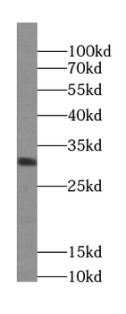 ZNRF2 Antibody
