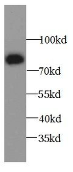 ALOX15B Rabbit Polyclonal Antibody
