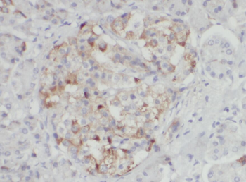 ALOX15B Rabbit Polyclonal Antibody