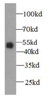 A4GALT Rabbit Polyclonal Antibody