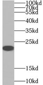 AANAT Rabbit Polyclonal Antibody