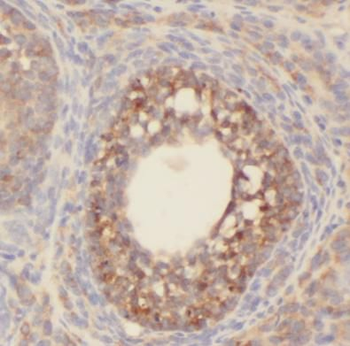 AANAT Rabbit Polyclonal Antibody