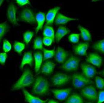ABAT Rabbit Polyclonal Antibody