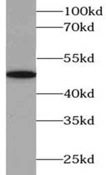 ABAT Rabbit Polyclonal Antibody