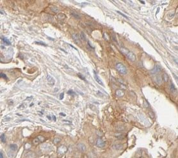 ABAT Rabbit Polyclonal Antibody