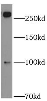 ABCA2 Rabbit Polyclonal Antibody