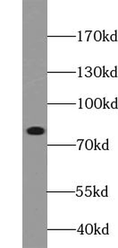 ABCB10 Rabbit Polyclonal Antibody
