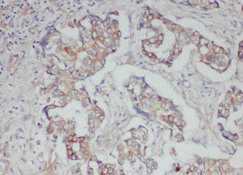 ABCB6 Rabbit Polyclonal Antibody
