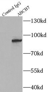 ABCB7 Rabbit Polyclonal Antibody