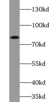 ABCB7 Rabbit Polyclonal Antibody