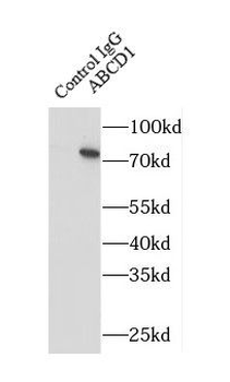 ABCD1 Rabbit Polyclonal Antibody