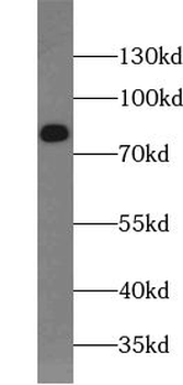 ABCD1 Rabbit Polyclonal Antibody