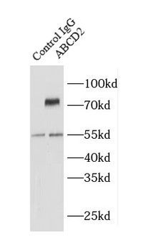 ABCD2 Rabbit Polyclonal Antibody