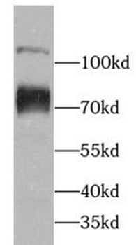 ABCF2 Rabbit Polyclonal Antibody