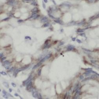 ABCF2 Rabbit Polyclonal Antibody