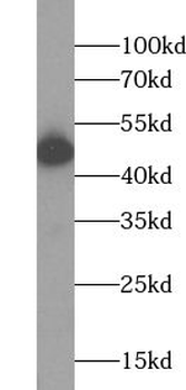 ABHD2 Rabbit Polyclonal Antibody