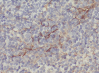 ABHD2 Rabbit Polyclonal Antibody