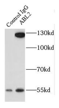 ABL2 Rabbit Polyclonal Antibody