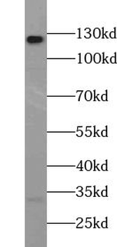 ABL2 Rabbit Polyclonal Antibody